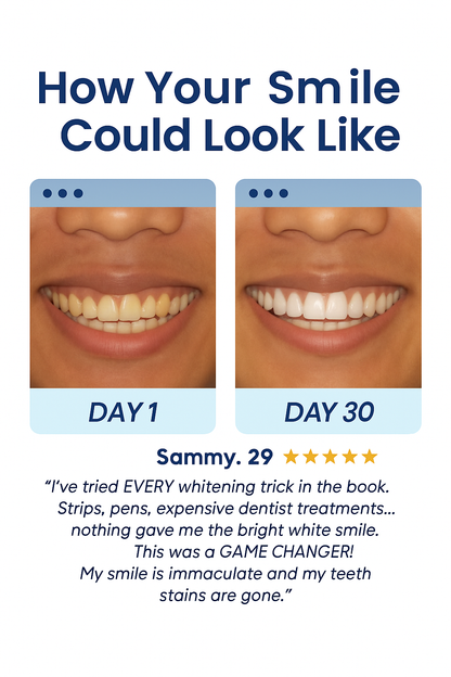 Clean Every Tooth in 30 Seconds—Automatically